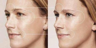 Serum chống lão hoá