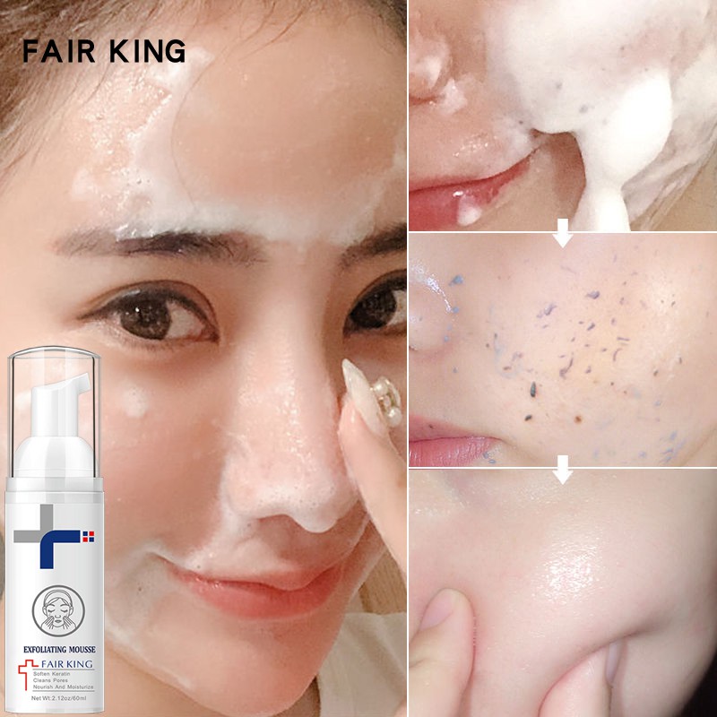 [Hàng mới về] Gel Tẩy Tế Bào Chết Fair King Dưỡng Ẩm Làm Sạch Sâu Đa Năng