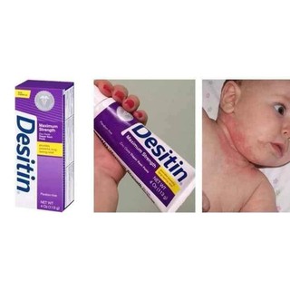 Kem hăm Desitin tím Mỹ