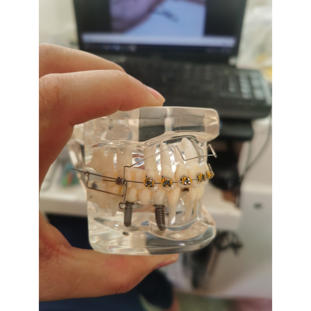 Cung tiện ích chỉnh nha, cung đánh lún ,dây SS mỹ