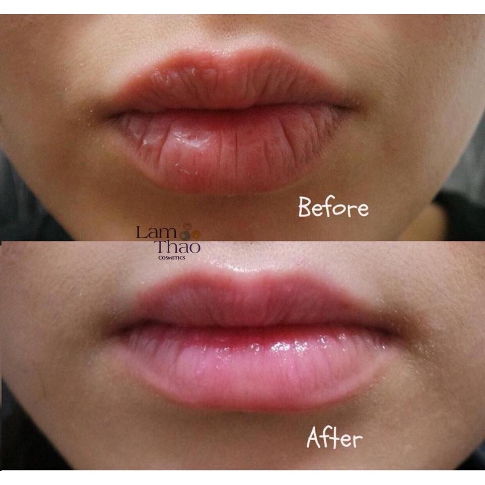 Serum làm căng và dưỡng môi Hyaluron Lip Push-up Serum Eveline | BigBuy360 - bigbuy360.vn