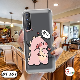 Ốp lưng dẻo OPPO RENO 3 4G/ A91