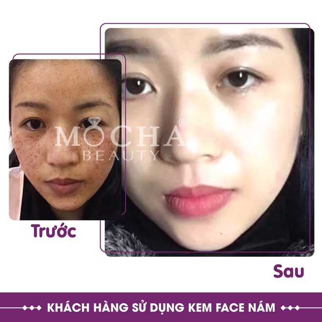 KEM FACE NÁM MOCHA | BigBuy360 - bigbuy360.vn