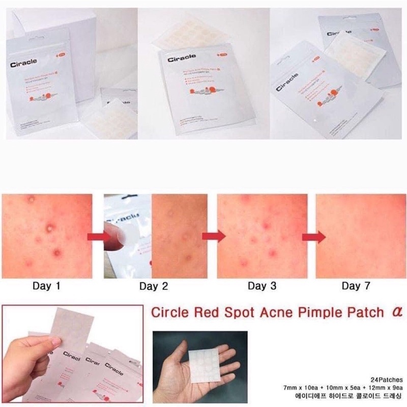 Miếng dán m.ụn Ciracle Red Spot Acne Pimple Patch Hàn Quốc