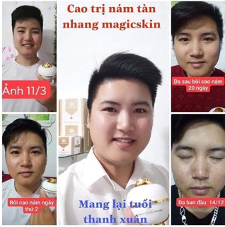CAO NÁM MAGIC SKIN