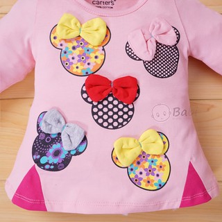 Bộ bé gái hình chuột Mickey