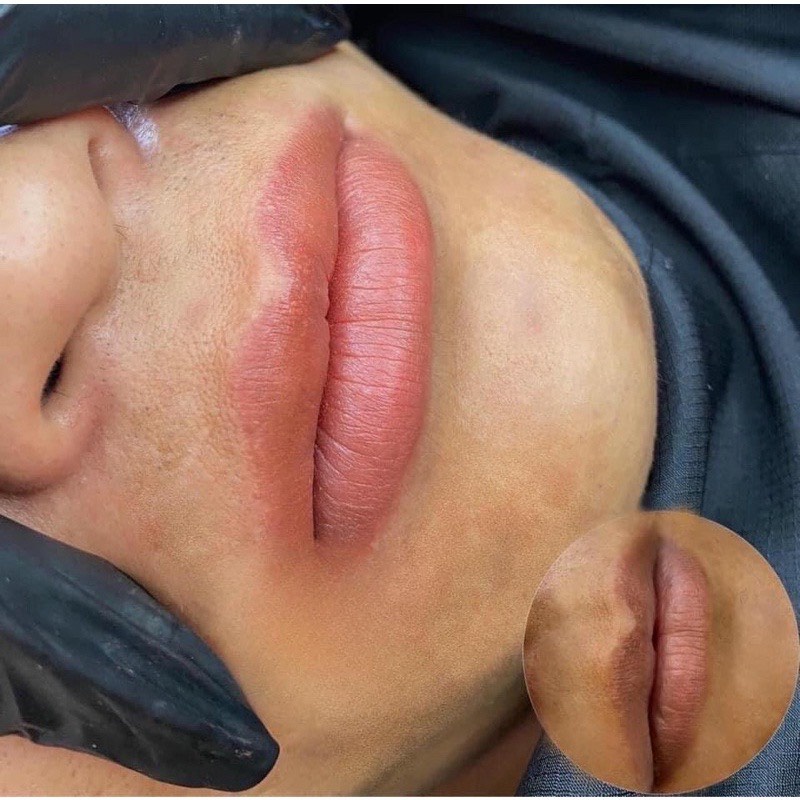 mực angelica siêu khử thâm màu hồng cam sữa