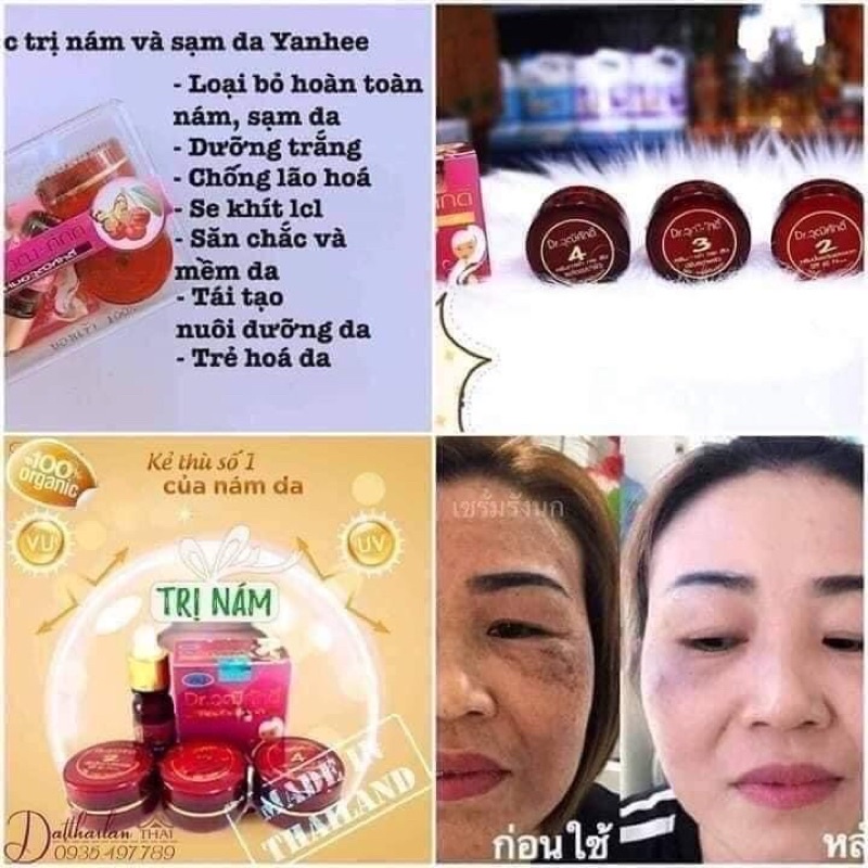 (Chính hãng) Bộ kem nám sạm da đỏ Thái Lan