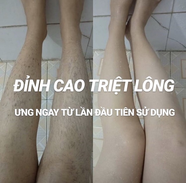 Combo Sỉ 5 Tuýp Kem Tẩy Lông Iwax