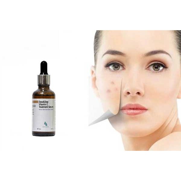 Serum dưỡng da Chống lão hóa Tái tạo da Dew & Dew Vitamin C Treatment Chính Hãng Hàn Quốc