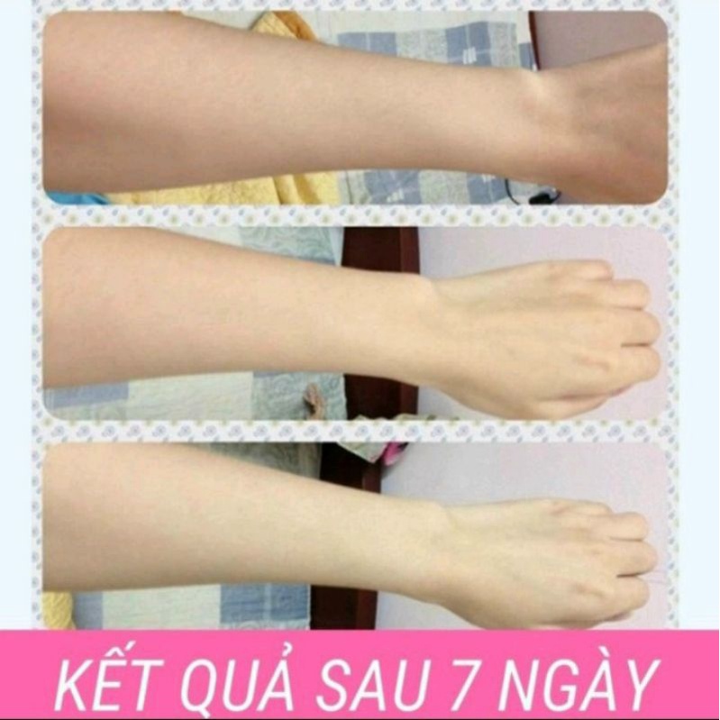 Kem Topcare Ủ Trắng Da Body Toàn Thân