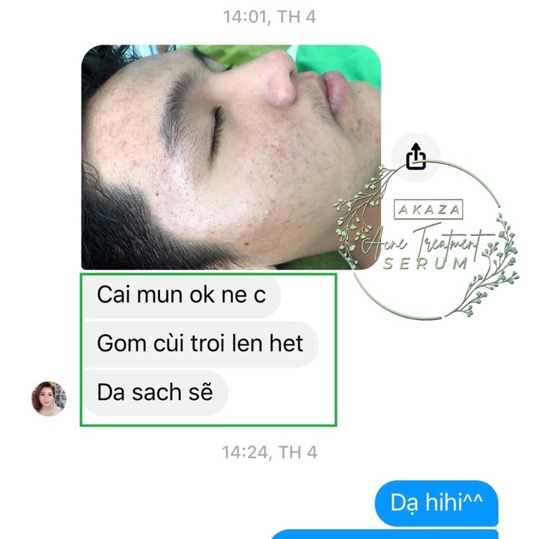 𝐒𝐄𝐑𝐔𝐌 𝐃𝐄𝐓𝐎𝐗 𝐓𝐑𝐈̣ 𝐌𝐔̣𝐍 𝐀𝐊𝐀𝐙𝐀 | BigBuy360 - bigbuy360.vn