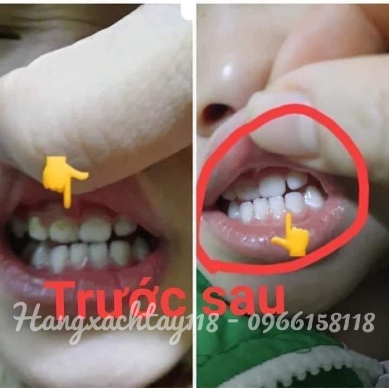 [Chính hãng] GEL NGỪA SÚN RĂNG VECNI FLOUR LOẠI ĐỎ CAO CẤP