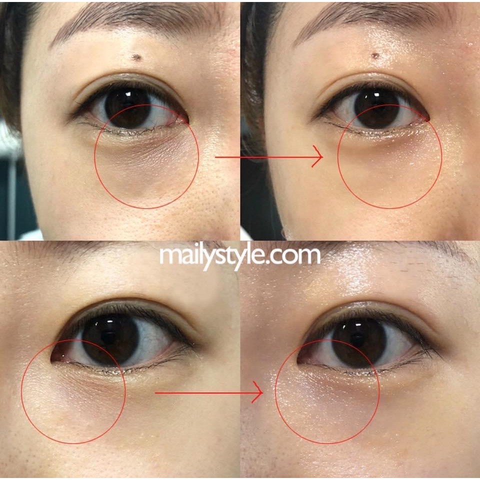 [ISOI] KEM MẮT ISOI CHO DA LÃO HÓA ISOI BULGARIAN ROSE INTENSIVE LIFTING SPOT HÀN QUỐC | BigBuy360 - bigbuy360.vn