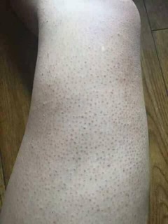 TẮM TRẮNG BỘT THẢO DƯỢC QUYÊN LARA