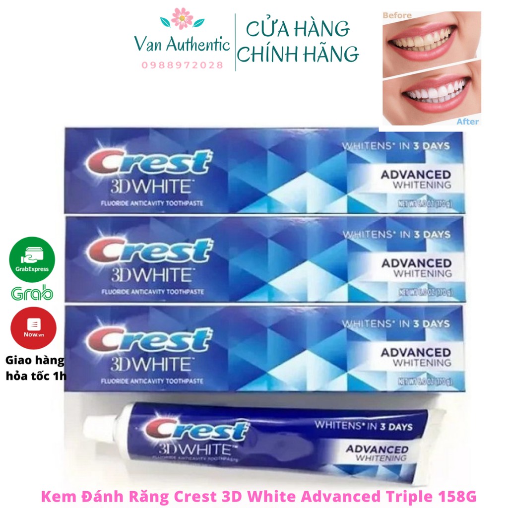 Kem đánh răng Crest 3D White Advanced Triple Whitening tuýp 158g từ Mỹ