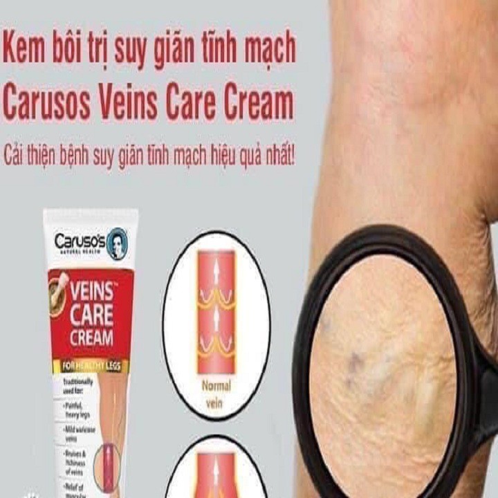 [Yêu Thích] Kem bôi da suy giảm tĩnh mạch giãn mạch máu Vein Clear Cream 75g