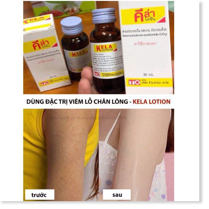 [Mã chiết khấu giảm giá mỹ phẩm sỉ chính hãng] Kella Lotion - Giảm Viêm Lỗ Chân Lông 80%