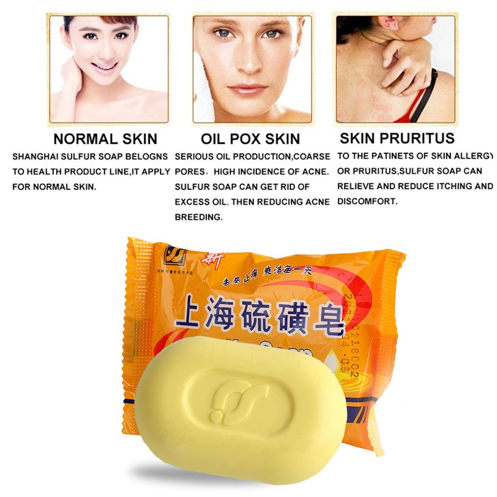 MXBEAUTY Fungal Sulfur Soap Skin Anti Soap Whitening Psoriasis Seborrhea Sulfur Bath Dermatitis Scabies/Multicolor