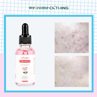 [Hàng mới về] Serum dưỡng da mặt với tinh chất hoa hồng cải thiện mụn hạn chế lão hóa chăm sóc da 30ml