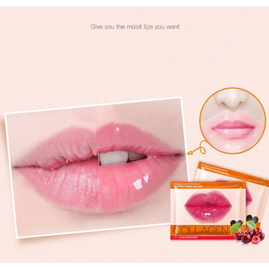 Mặt Nạ Môi Collagen Cherry Images Giúp Môi Mềm Mại Hồng Hào Cằn Bóng Dưỡng Cấp Ẩm Cho Môi