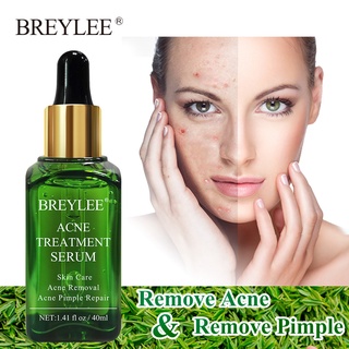 Serum hỗ trợ giảm mụn breylee 40ml làm trắng da