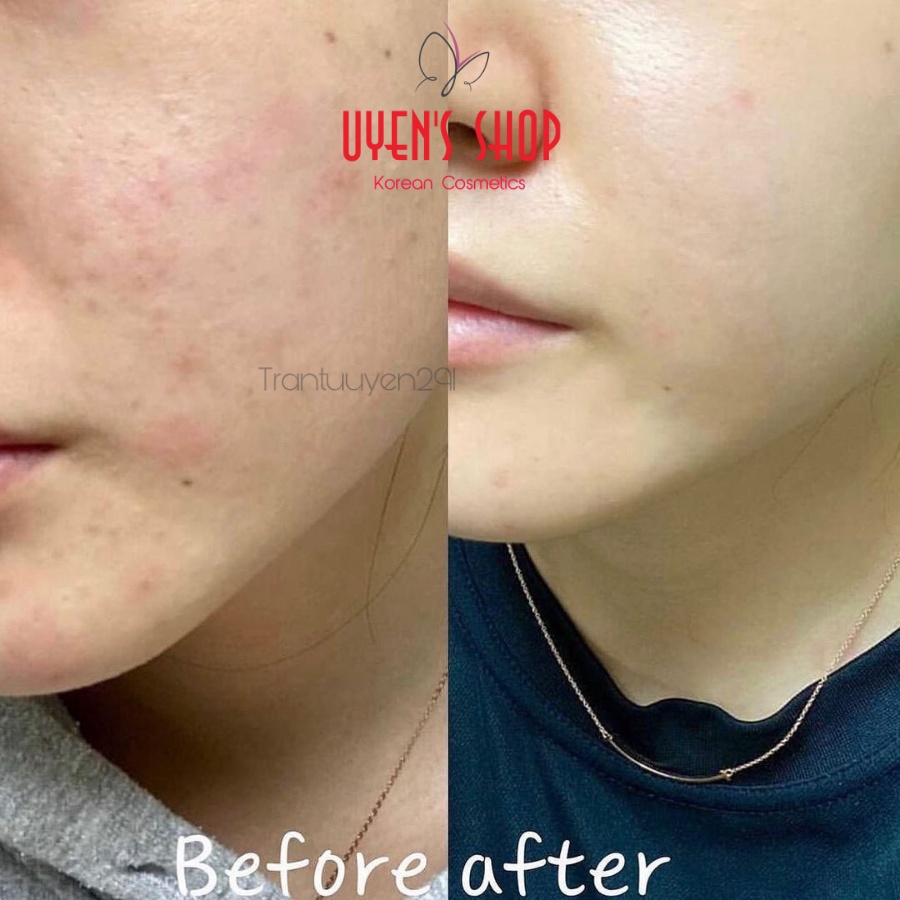 Tinh chất giảm mụn, phục hồi da chiết xuất rau má Skin1004 Madagascar Centella Asiatica 100 Ampoule 55ml/100ml