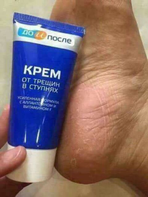 Kem trị nứt nẻ chân Nga BQ | BigBuy360 - bigbuy360.vn