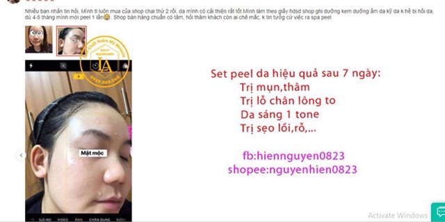 Peel TCA Zenus 50% | BigBuy360 - bigbuy360.vn