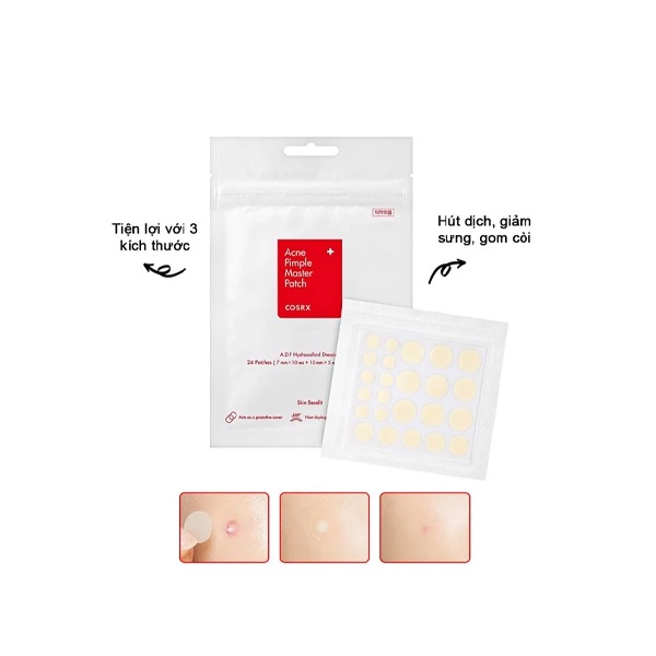 Miếng Dán Mụn Che Phủ Nốt Mụn Cosrx Acne Pimple Master Patch