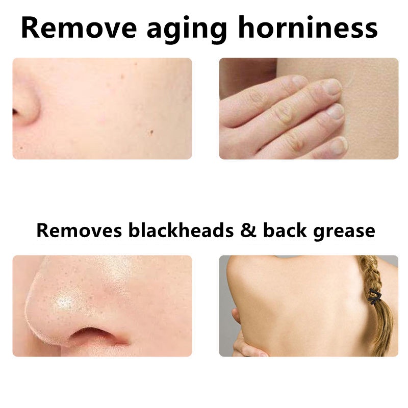 (Hàng Mới Về) Gel Tẩy Tế Bào Chết Làm Sạch Sâu 100g | BigBuy360 - bigbuy360.vn