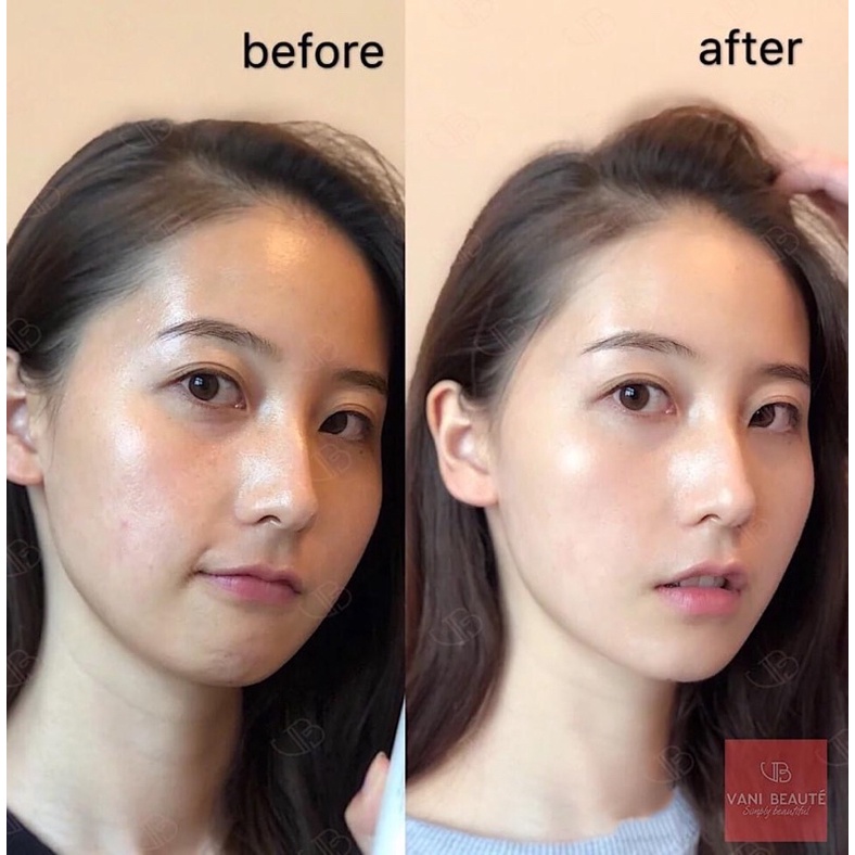 Nia 20% Paula’s Choice_Tinh chất dưỡng da thu nhỏ lỗ chân lông