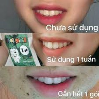 BỘT TẨY TRẮNG RĂNG BAKING SODA BẠC HÀ