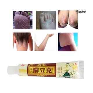 Ready Stock Skin Treatment Traditional Chinese Herbal Antibacterial Cream Psoriasis Ointment