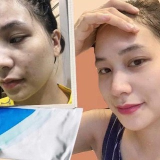 KEM A313 BẢN NỘI ĐỊA PHÁP (RETINOL A313)