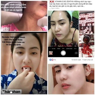 Vitamin e đỏ Nga 400mg lọ thủy tinh