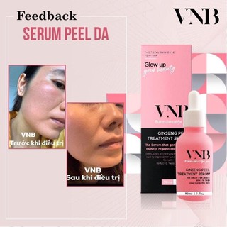 [combo ] serum peel da dạng nhẹ vnb