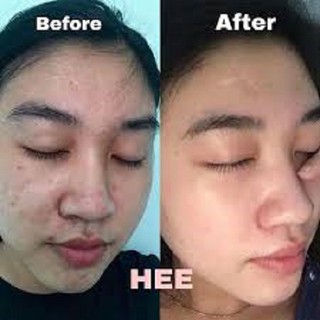 thuốt bắc tái tạo da 50ml