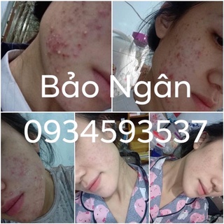 Thảo dược tái tạo da