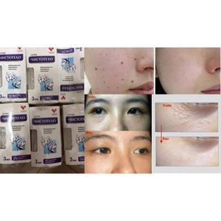 Gel tẩy mụn thịt, mụn ruồi...