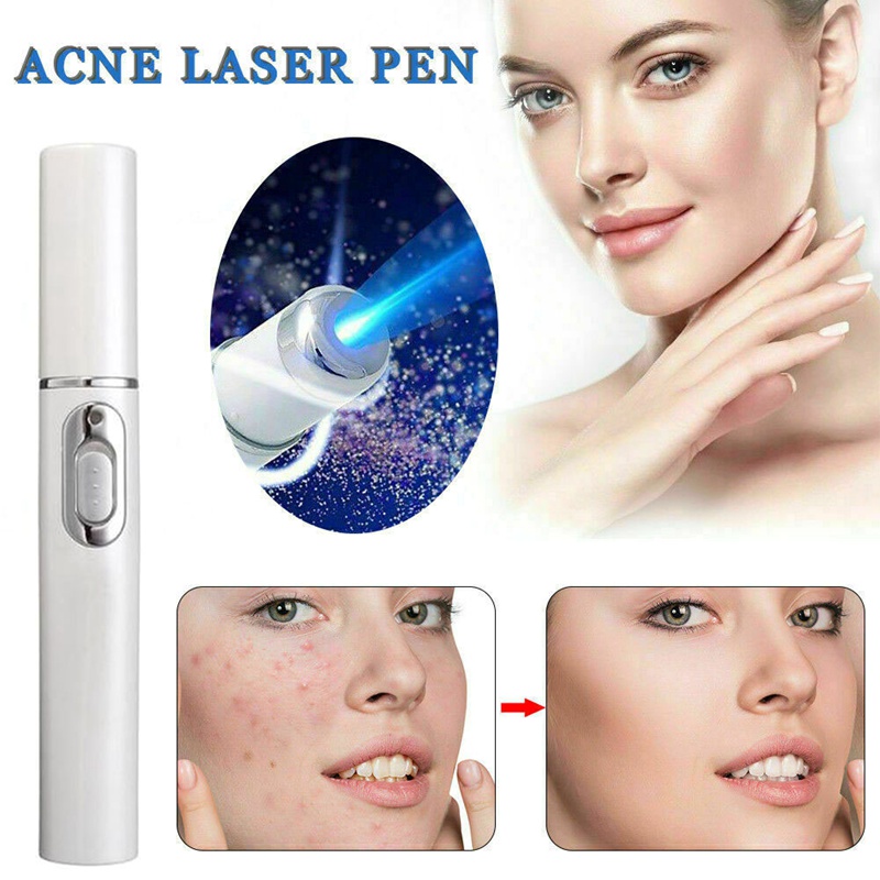 (Hàng Mới Về) Bút Laser Ánh Sáng Xanh Dương Mềm Trị Mụn Và Nếp Nhăn Hiệu Quả