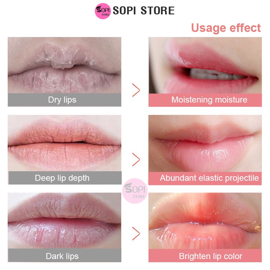 Mặt nạ môi collagen Cherry Images Bioaqua dưỡng môi căng bóng, hồng hào mask môi nội địa trung - Sopi Store