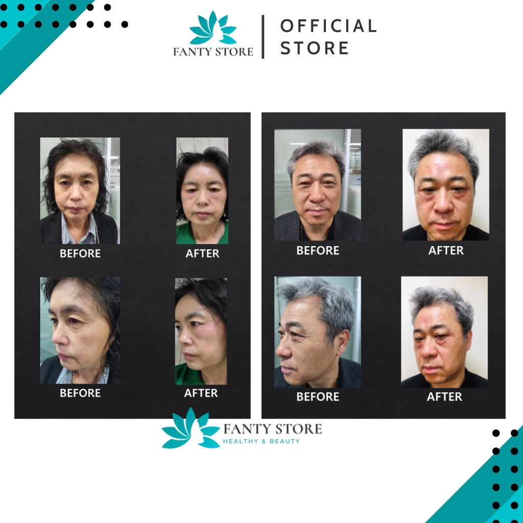 (Spa) TINH CHẤT TIÊM OBSESS WELL  Căng bóng, nâng cơ, làm trắng tức thì