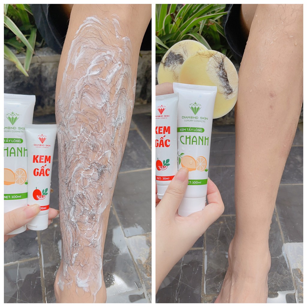 Kem tẩy lông nách,lông vùng kín,lông chân tay DIAMON SKIN triệt sạch bất chấp mọi loại lông vĩnh viễn nhanh gọn