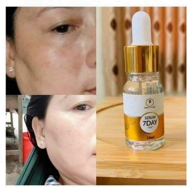 SERUM HUYẾT THANH TRUYỀN TRẮNG 7 DAY