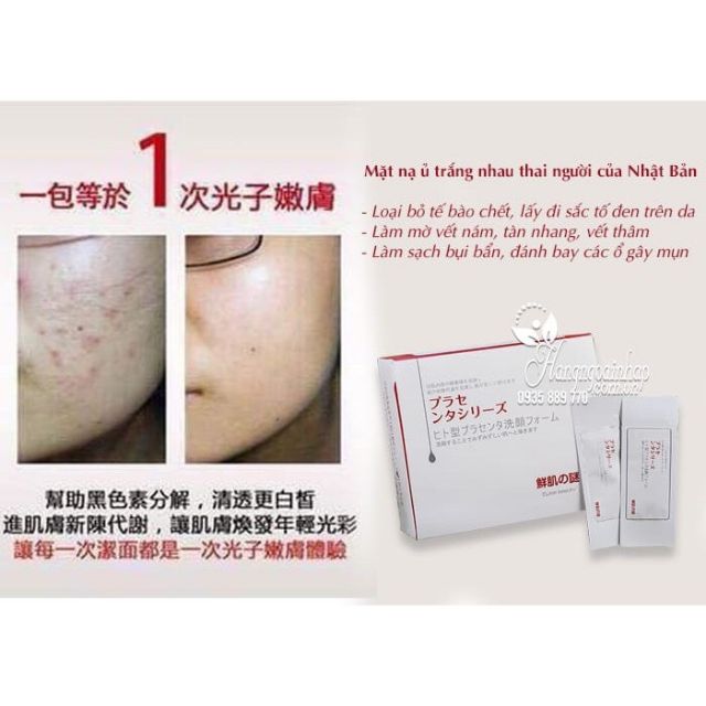 Gói mặt nạ ủ trắng nhau thai Nhật Bản chính hãng | BigBuy360 - bigbuy360.vn