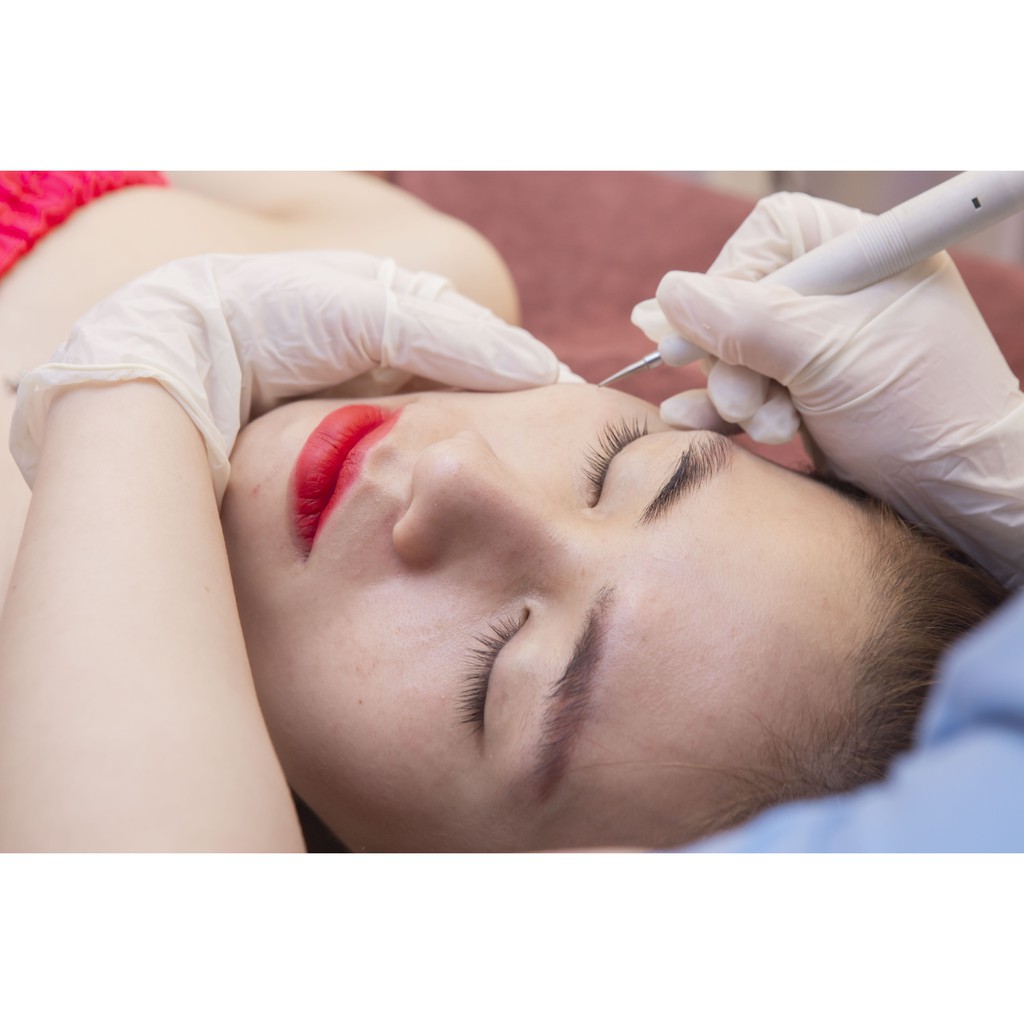 HN - Tẩy Nốt Ruồi, Mụn Cóc, Tàn Nhang - Công Nghệ Pico Laser Tại Viện Thẩm Mỹ Quốc Tế Korea