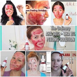 Serum The Ordinary – AHA 30% + BHA 2% Peeling Solution