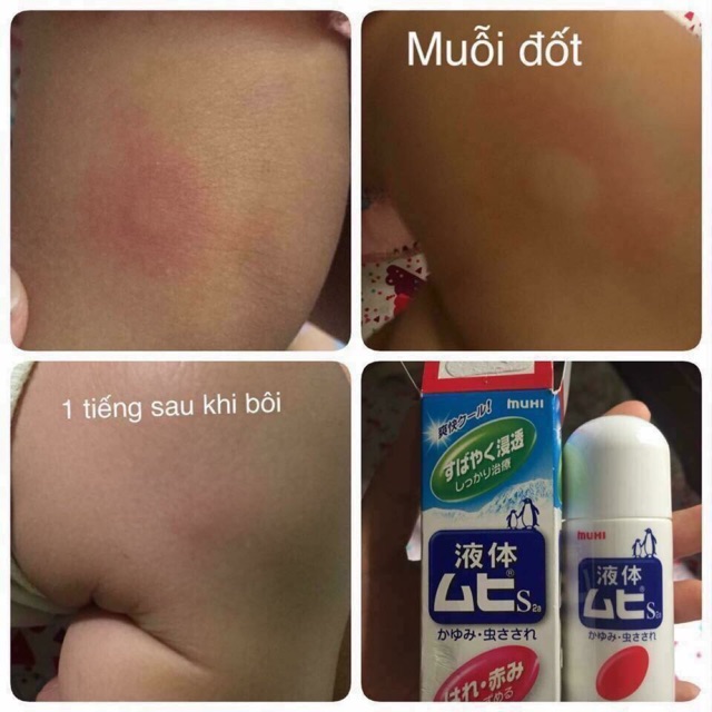 Lăn Trị Muỗi ,Côn Trùng Đốt MuHi Nhật Bản