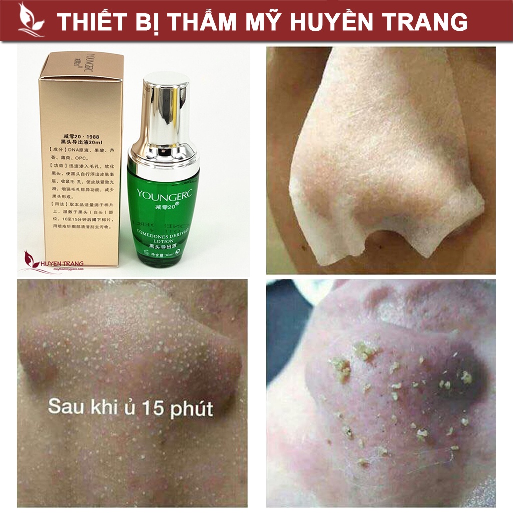 Tinh Chất Ủ Mụn Siêu Nhanh Yougerc - Thẩm Mỹ Huyền Trang NANOCEE